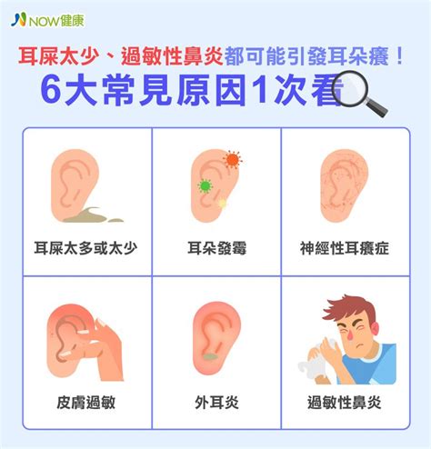 左耳癢代表什麼|【醫療保健】耳朵癢別急著掏耳朵！了解6個常見原。